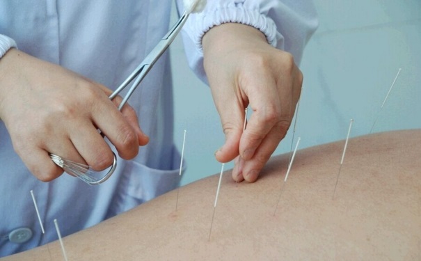 失眠了怎么进行中医治疗？失眠的针灸疗法是怎么样的？[